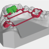 TORNILLO EXPANSOR PARA LA ARCADA INFERIOR CAD CAM TOOTH BORNE - 35-para-la-max-expansion-consentida - 1-pieza - 12-mm - 8-mm