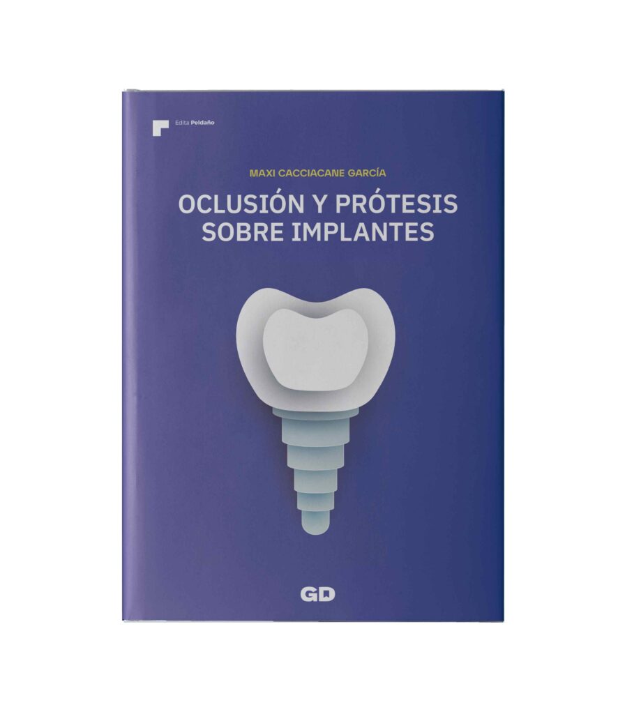 Libro publicado en 2023 por el doctor Maxi Cacciacane: 'Oclusión y prótesis sobre implantes'.