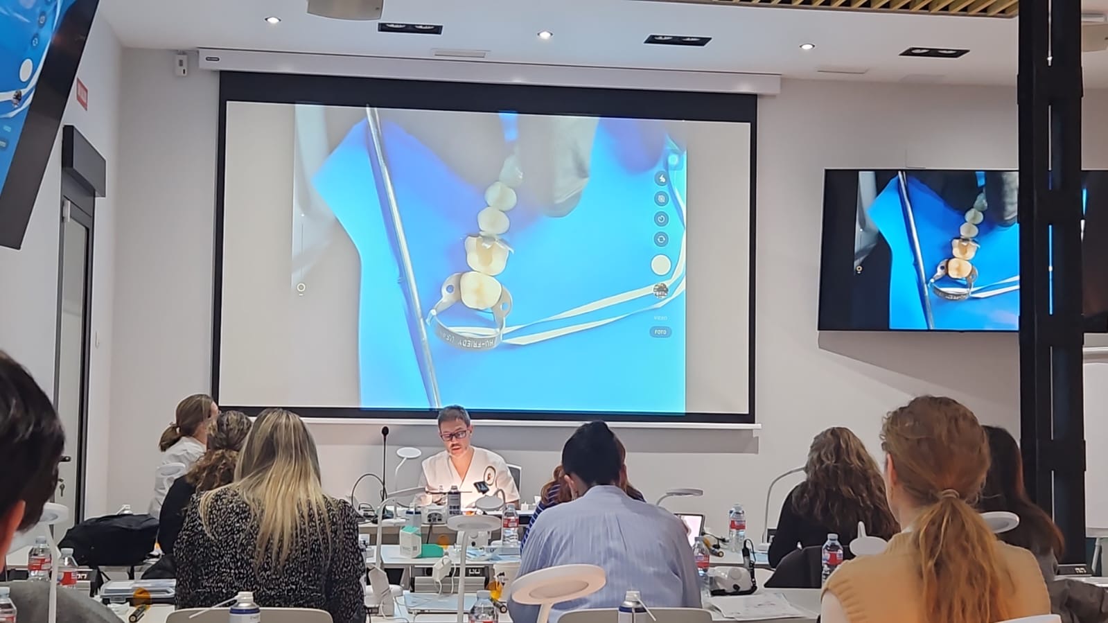 restauracion posteriores ucam madrid 01